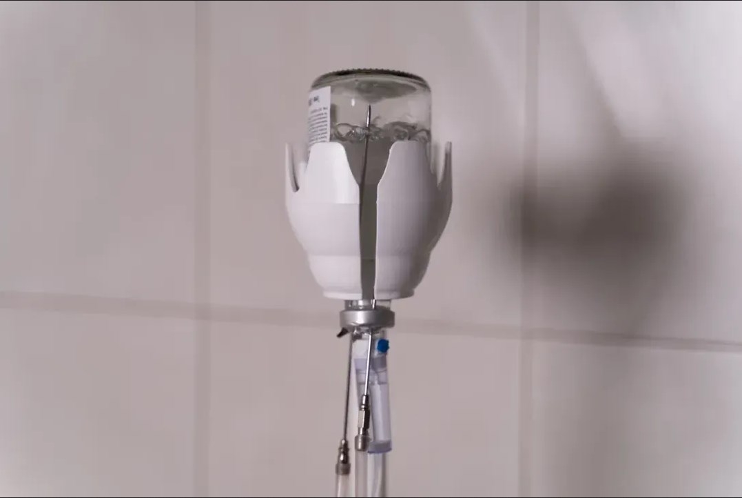 Преимущества озонотерапии